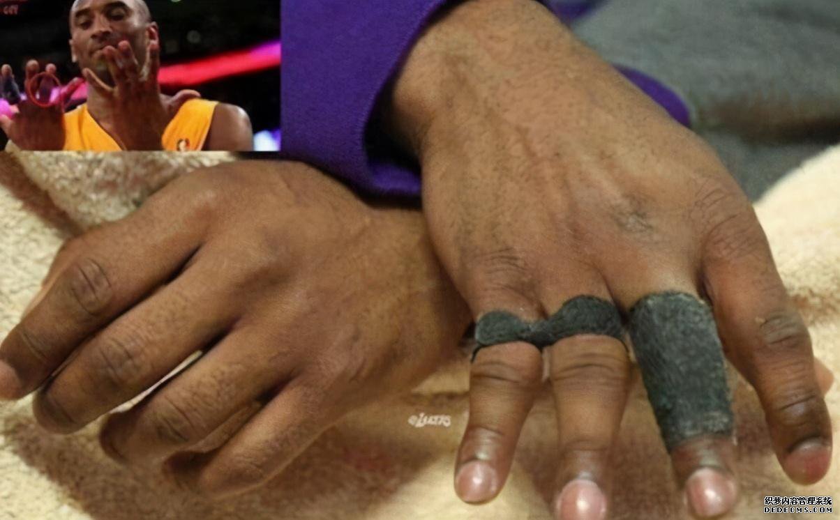 NBA球星为了成功有多不易？科比手指变形 詹皇脚似外星人